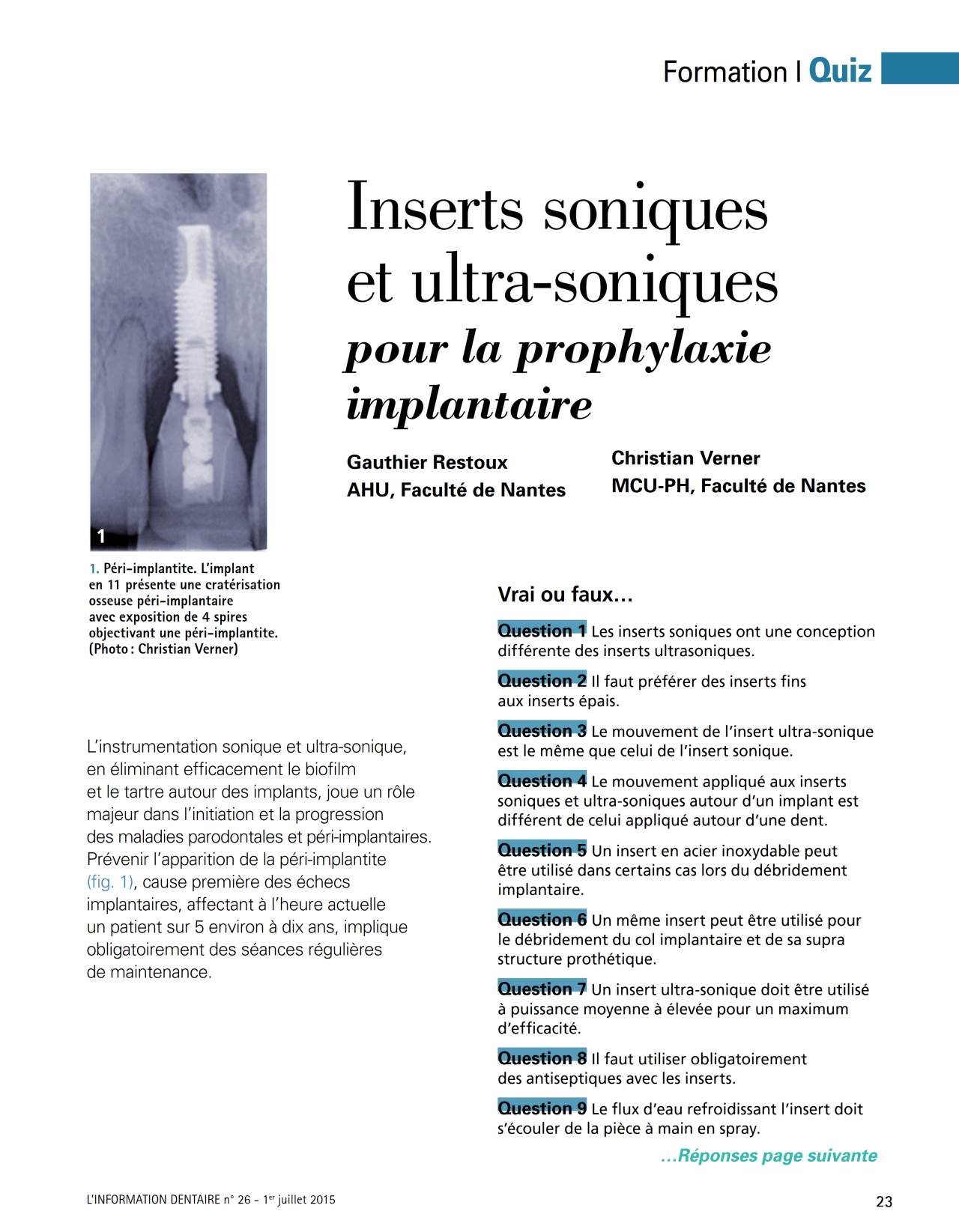 komet-dental-ceradrill-fachbericht-implantat-prophylaxe-quiz image 1