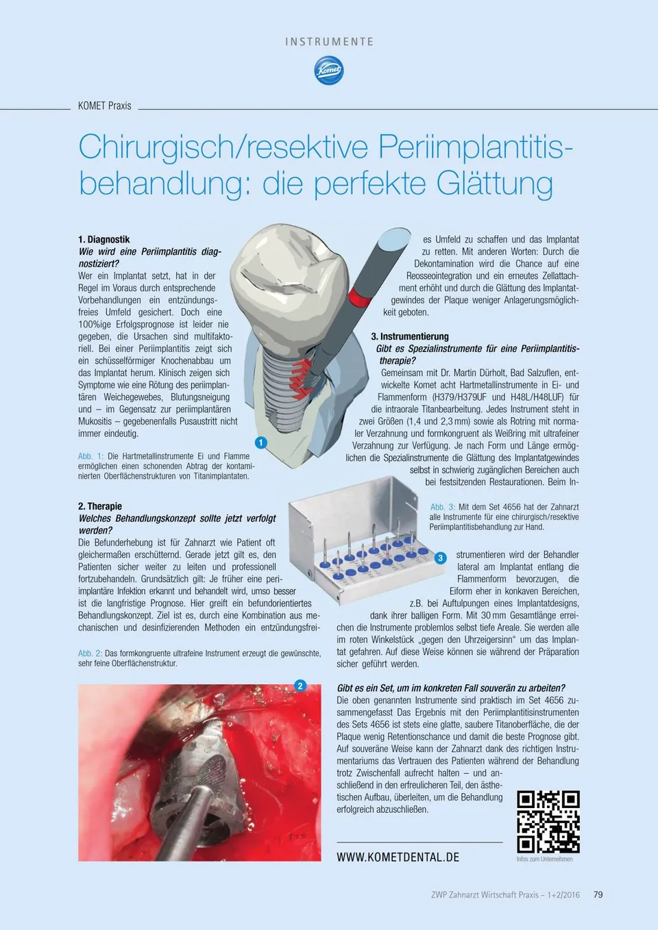 komet-dental-diao-2016-01-praxisinfo-periimplantitis image 1