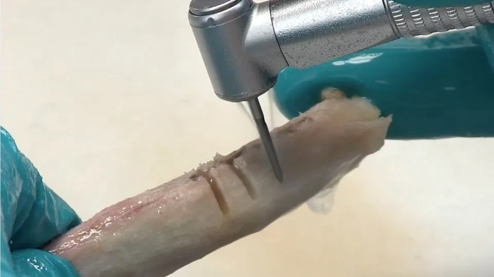 komet-dental-ceradrill-h162st-video-knochenfr-ser image 1