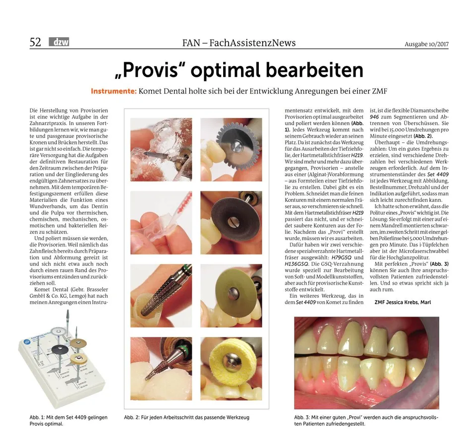 komet-dental-diao-provisorium-bearbeiten-fachbericht image 1