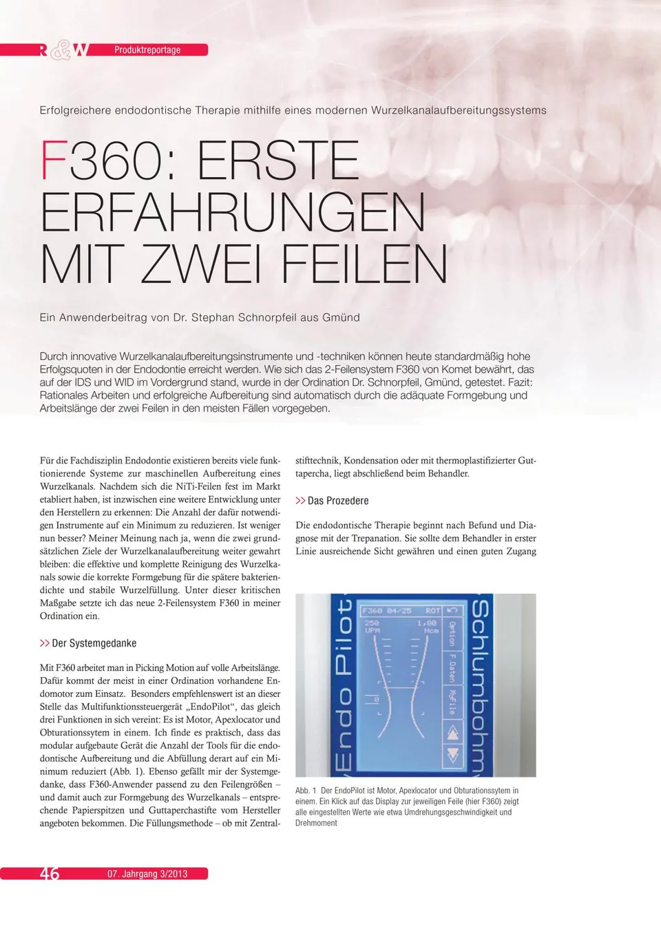 komet-f360-fachbericht-zwei-feilen-wurzelkanal-endo image 1