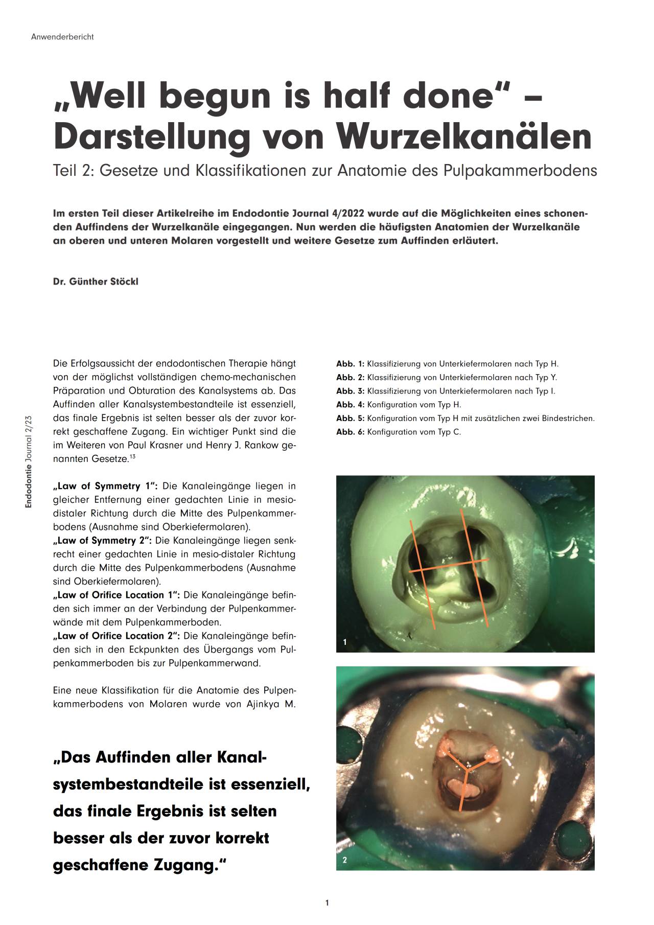 komet-dental-diao-endodontie-fachbericht-wurzelkan-le-teil-2 image 1