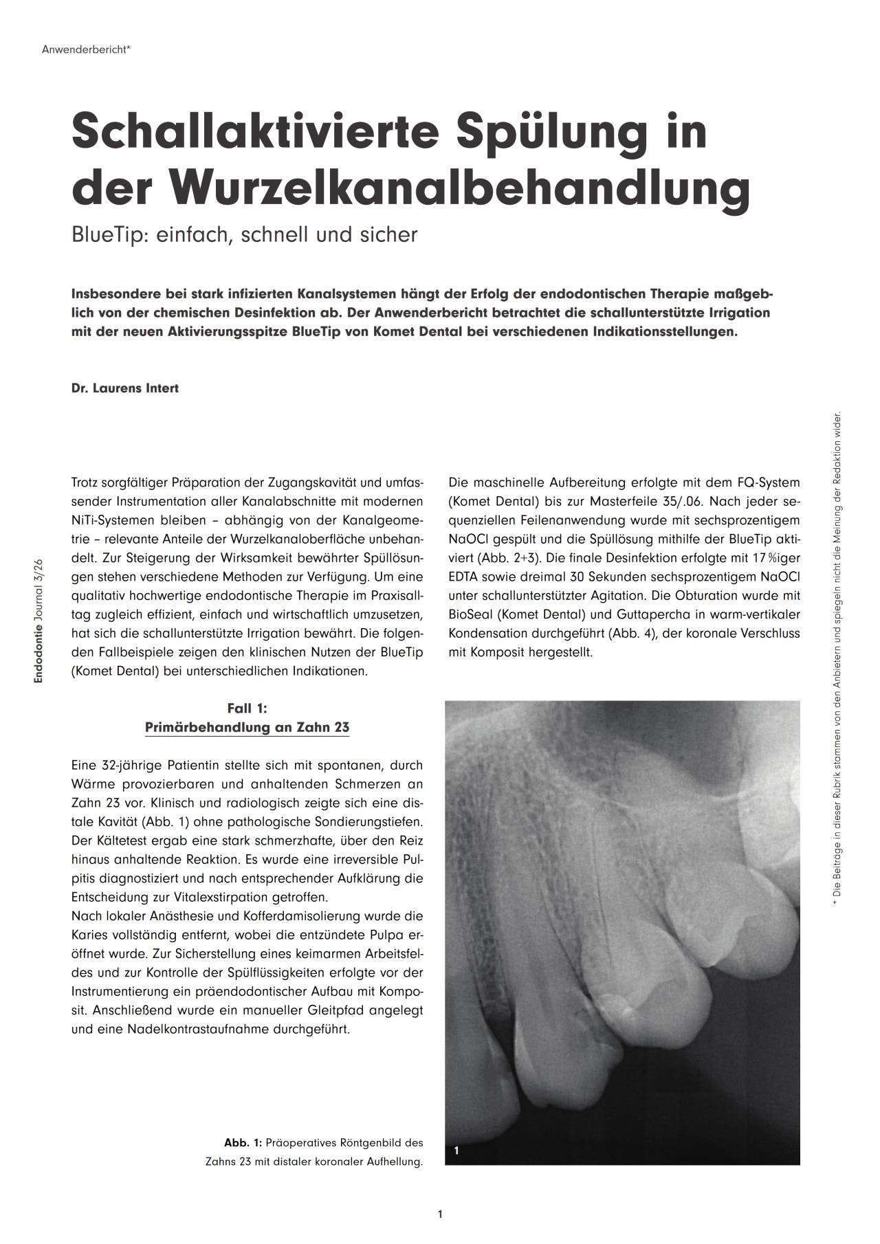 komet-dental-sonicline-fachbeitrag-schallsp-lung-wurzelkanal image 1