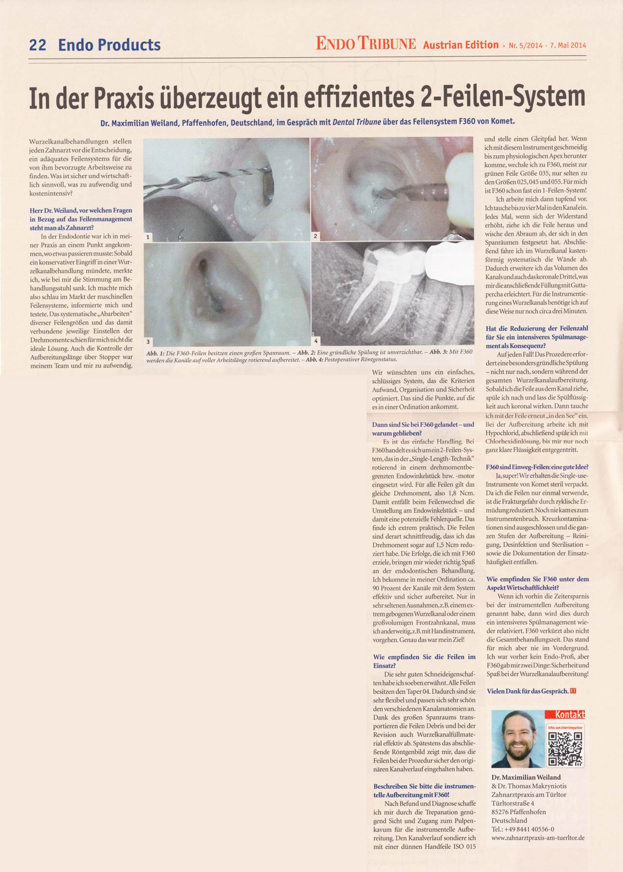 komet-dental-fq-fachartikel-2-feilen-system-endodontie image 1
