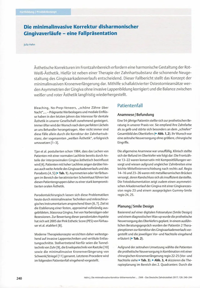 komet-diao-fachbericht-gingivaverlauf-frontzahn image 1