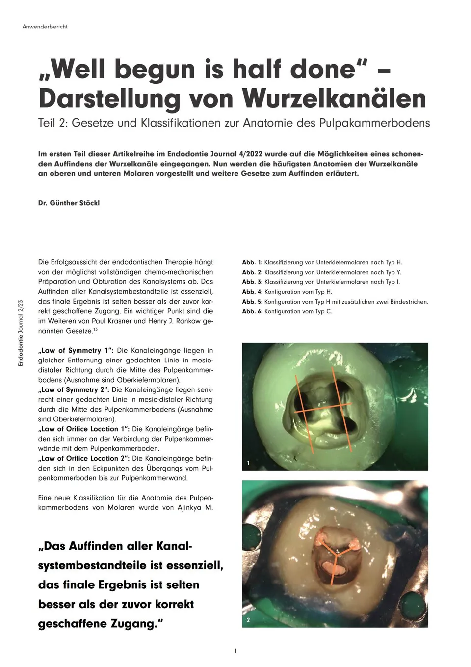 komet-dental-diao-endodontie-fachbericht-wurzelkan-le-teil-2 image 1