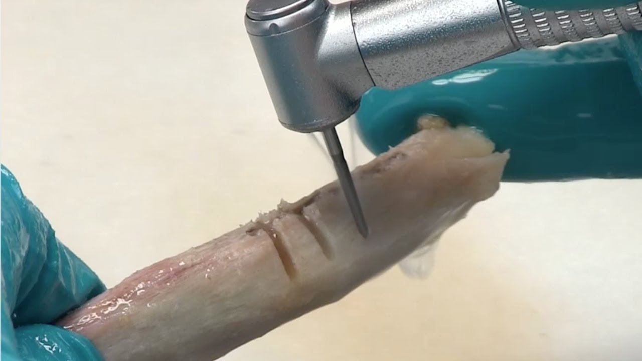 komet-dental-ceradrill-h162st-video-knochenfr-ser image 1