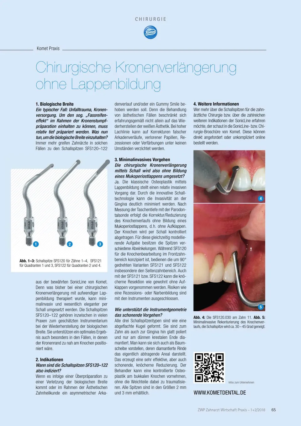 komet-dental-diao-komet-praxis-2018-02-heft-kronenverl-ngerung image 1