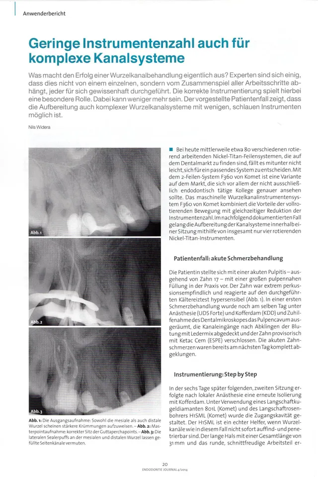 komet-diao-fachbericht-endodontie-kanalsysteme-2014 image 1