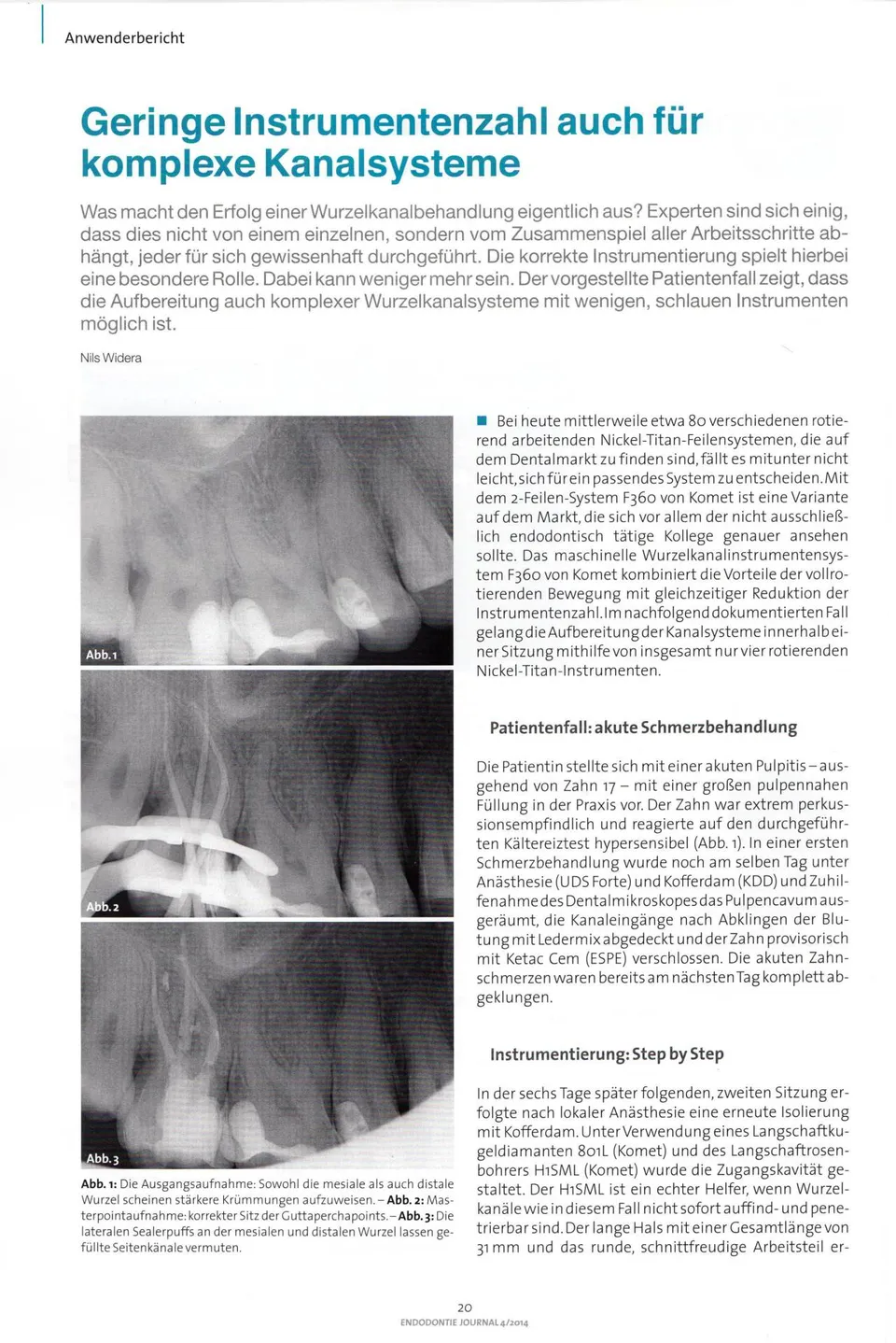 komet-diao-fachbericht-endodontie-kanalsysteme-2014 image 1