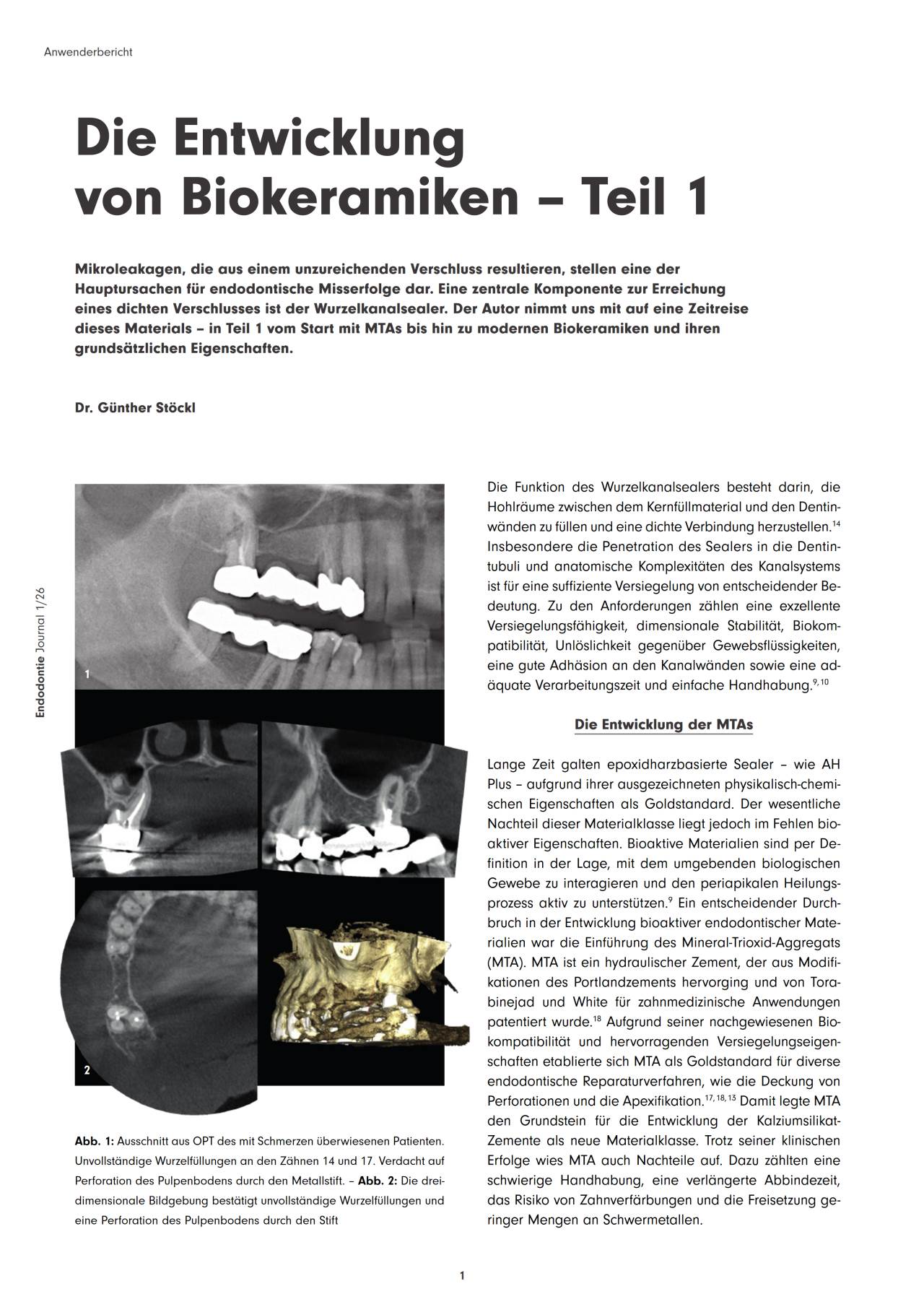 komet-dental-bioseal-fb-biokeramiken-teil-1-fachbericht image 1