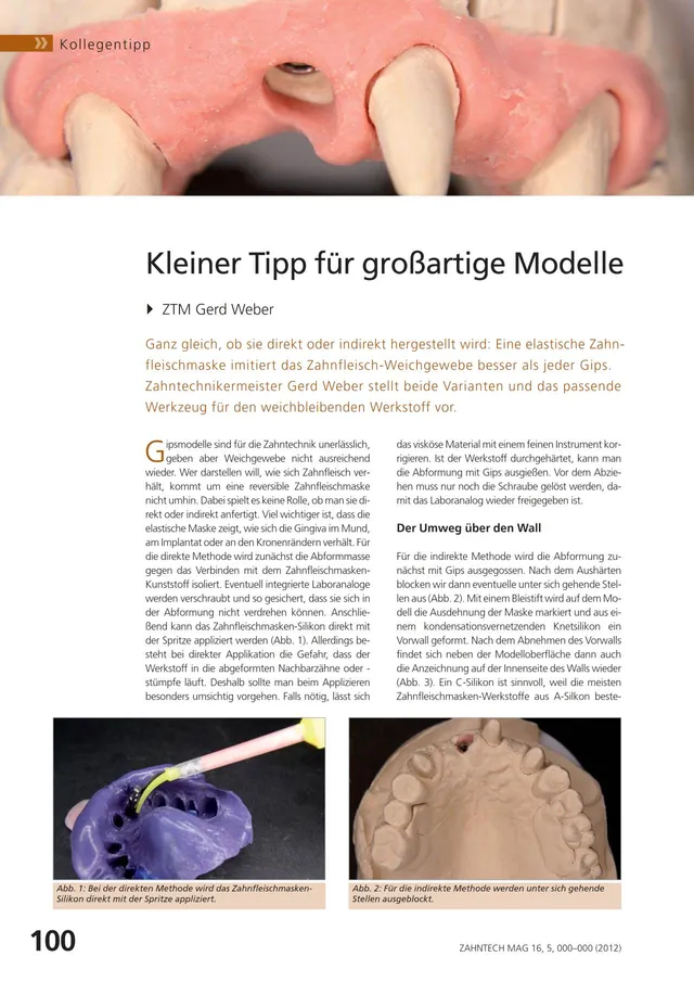komet-shax-fachbericht-zahnfleischmaske-modelle-gerd-weber image 1