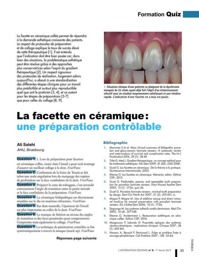 komet-dental-diao-quiz-keramik-veneers-fachartikel-salehi image 1