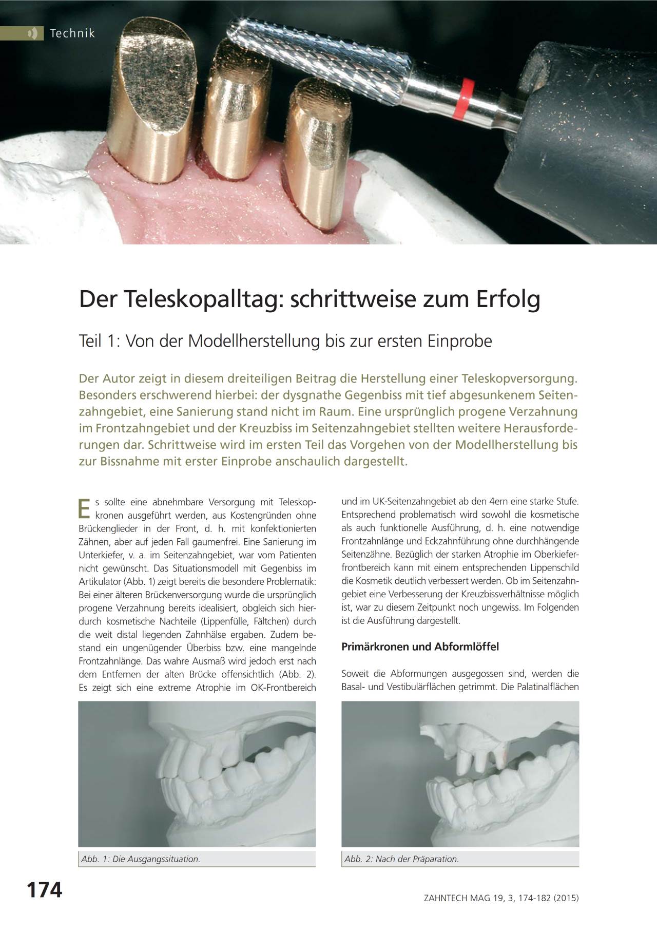 komet-dental-diao-fachbericht-teleskopalltag-teil-1-3-pdf image 1