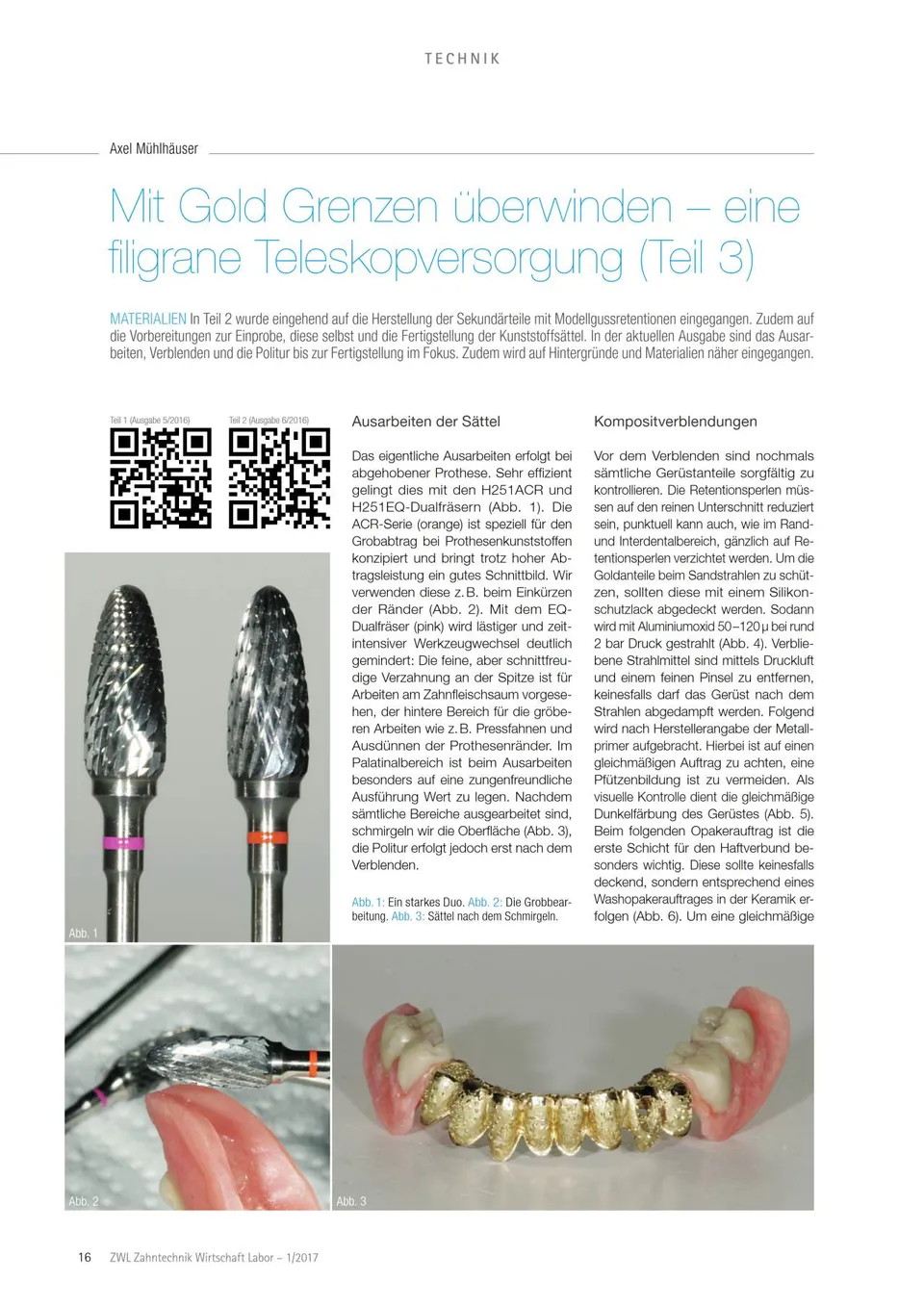 komet-diao-fachbericht-gold-teleskopversorgung-filigran image 1