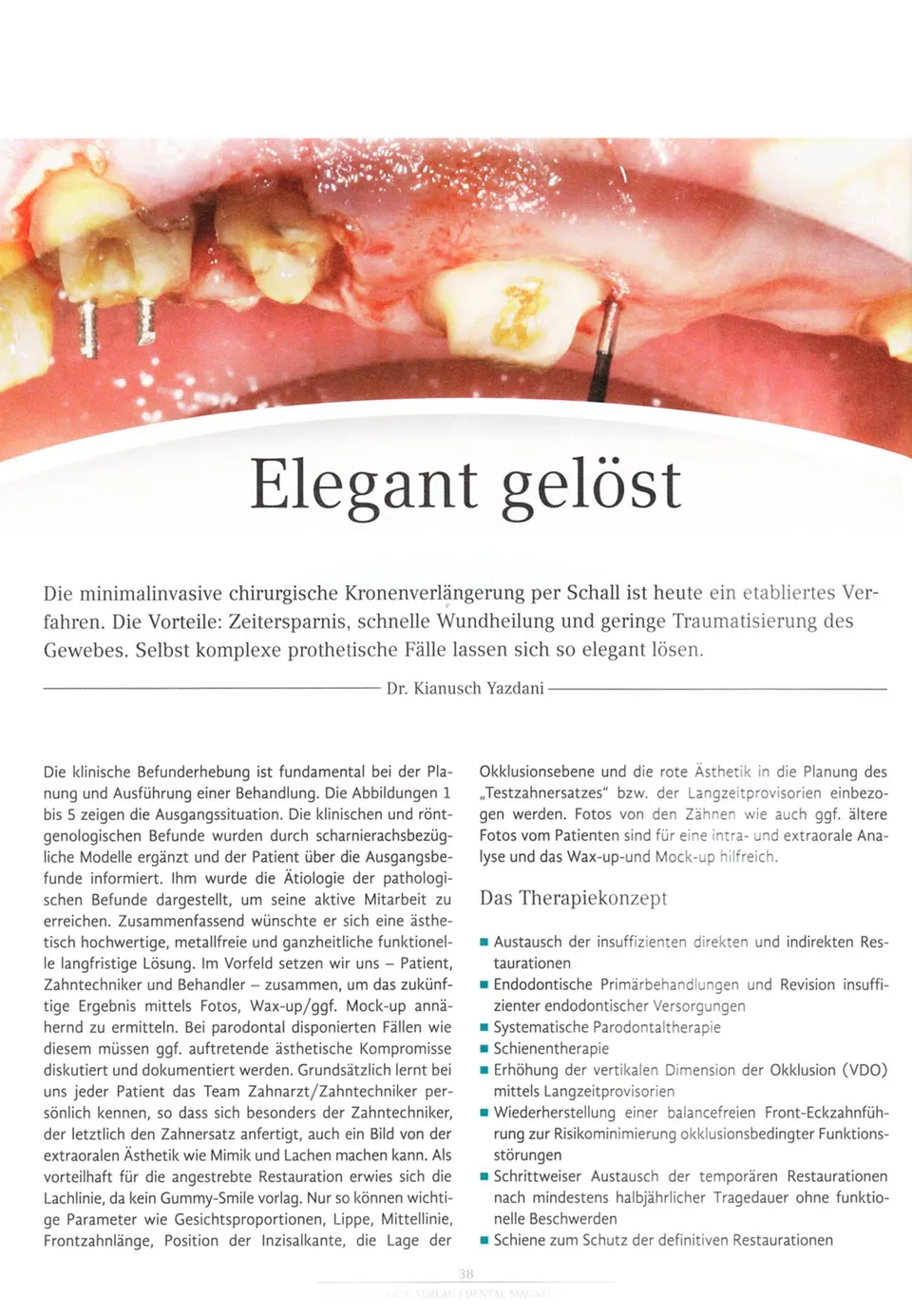 komet-diao-fachbericht-elegant-gel-st-kronenverl-ngerung image 1