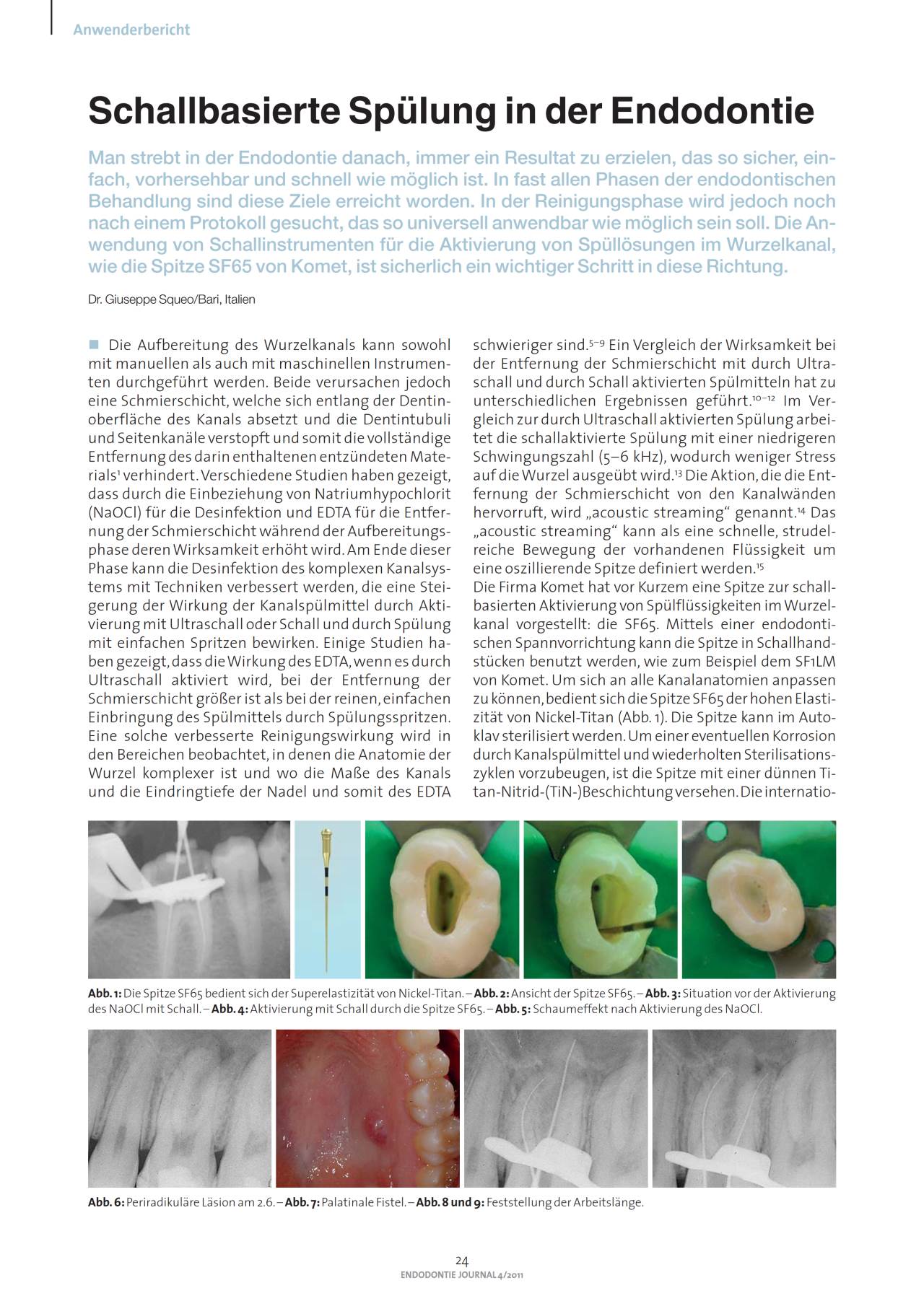 komet-sonicline-fachbericht-schallsp-lung-endodontie-sf65 image 1
