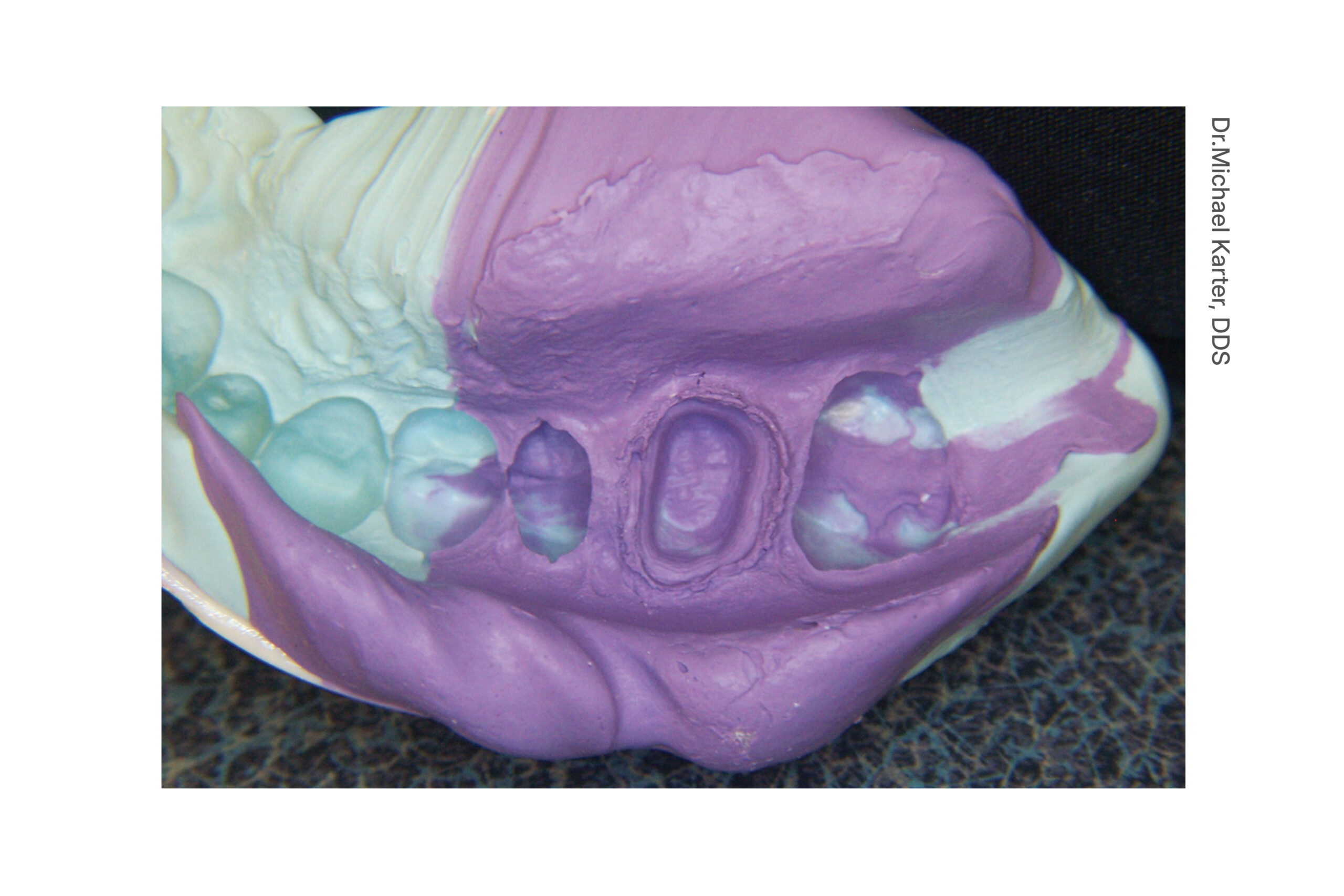 parkell-cinch-90-super-kartusche-abformmaterial-380ml-mittelviskos image 4