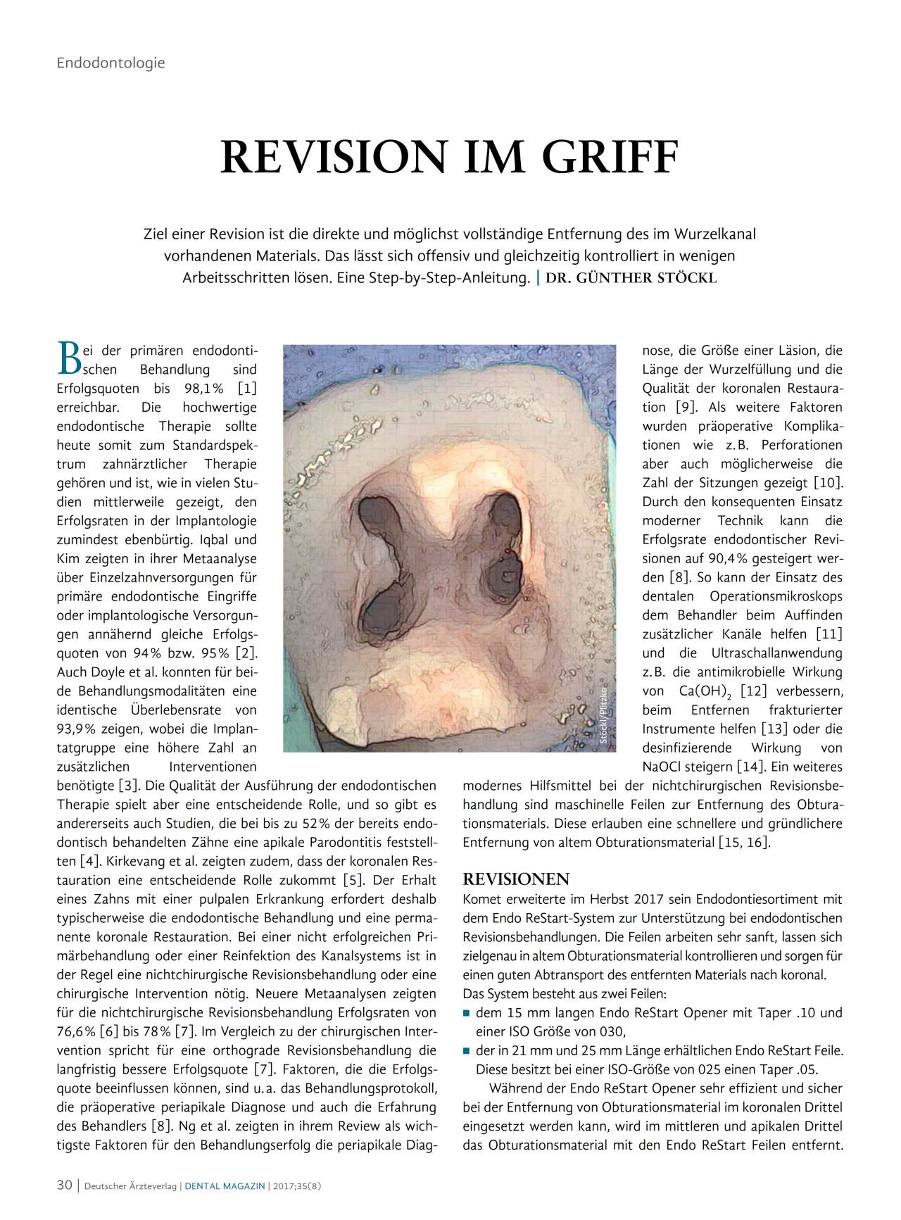 komet-dental-fq-fachbericht-revision-im-griff-endodontie image 1