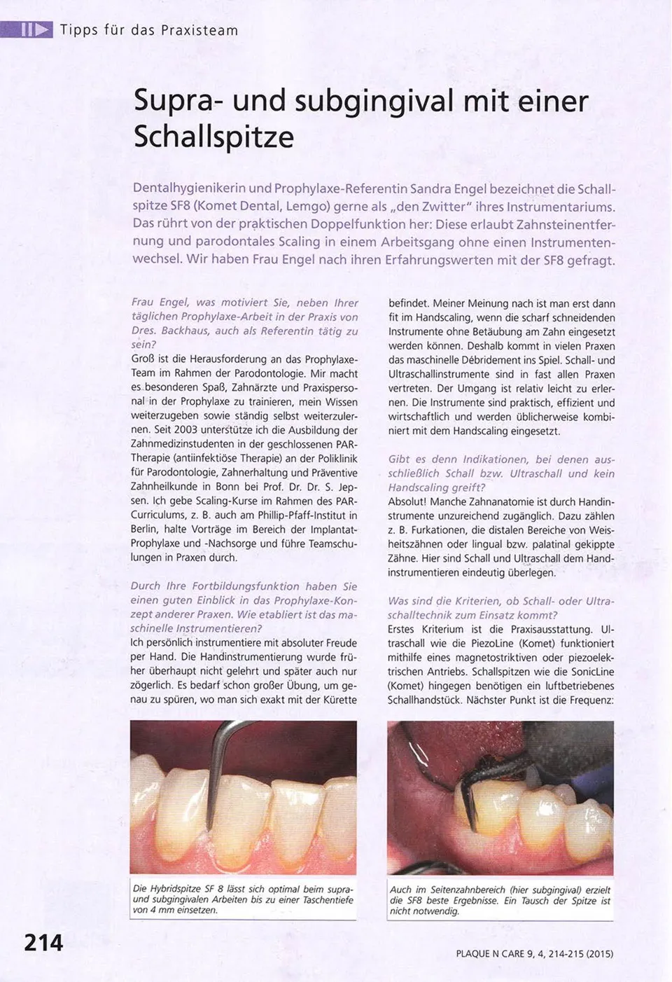 komet-dental-sonicline-fachbericht-schallspitze-prophylaxe image 1
