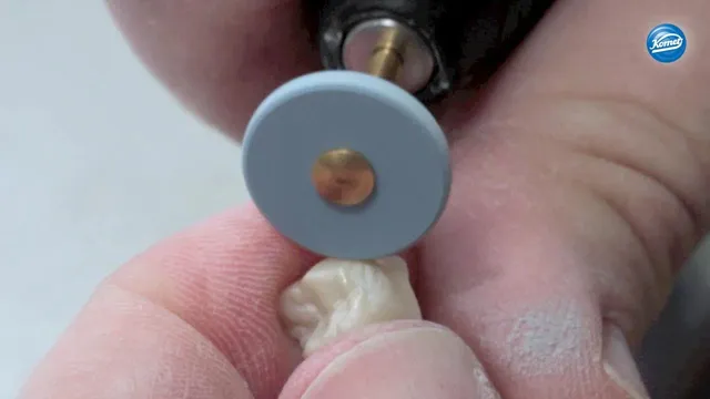 komet-art2-video-zirkonoxidkrone-polieren-seitenzahn image 1