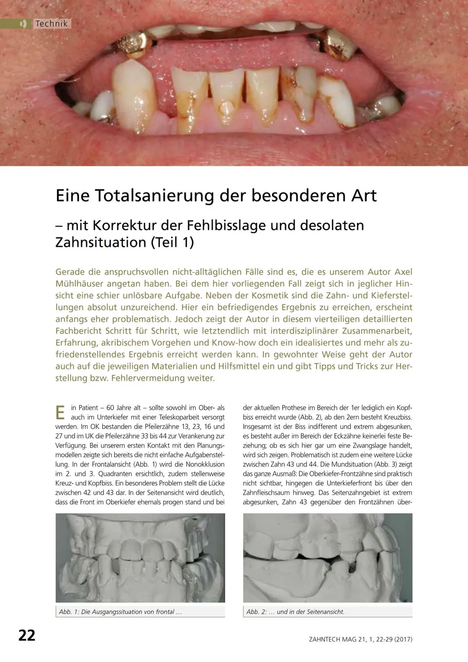 komet-dental-diao-fachbericht-totalsanierung-teil-1-2017 image 1