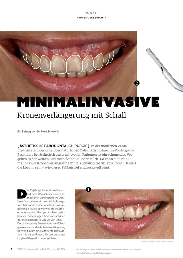 komet-dental-diao-komet-praxis-2025-09-fachbericht-schall image 1