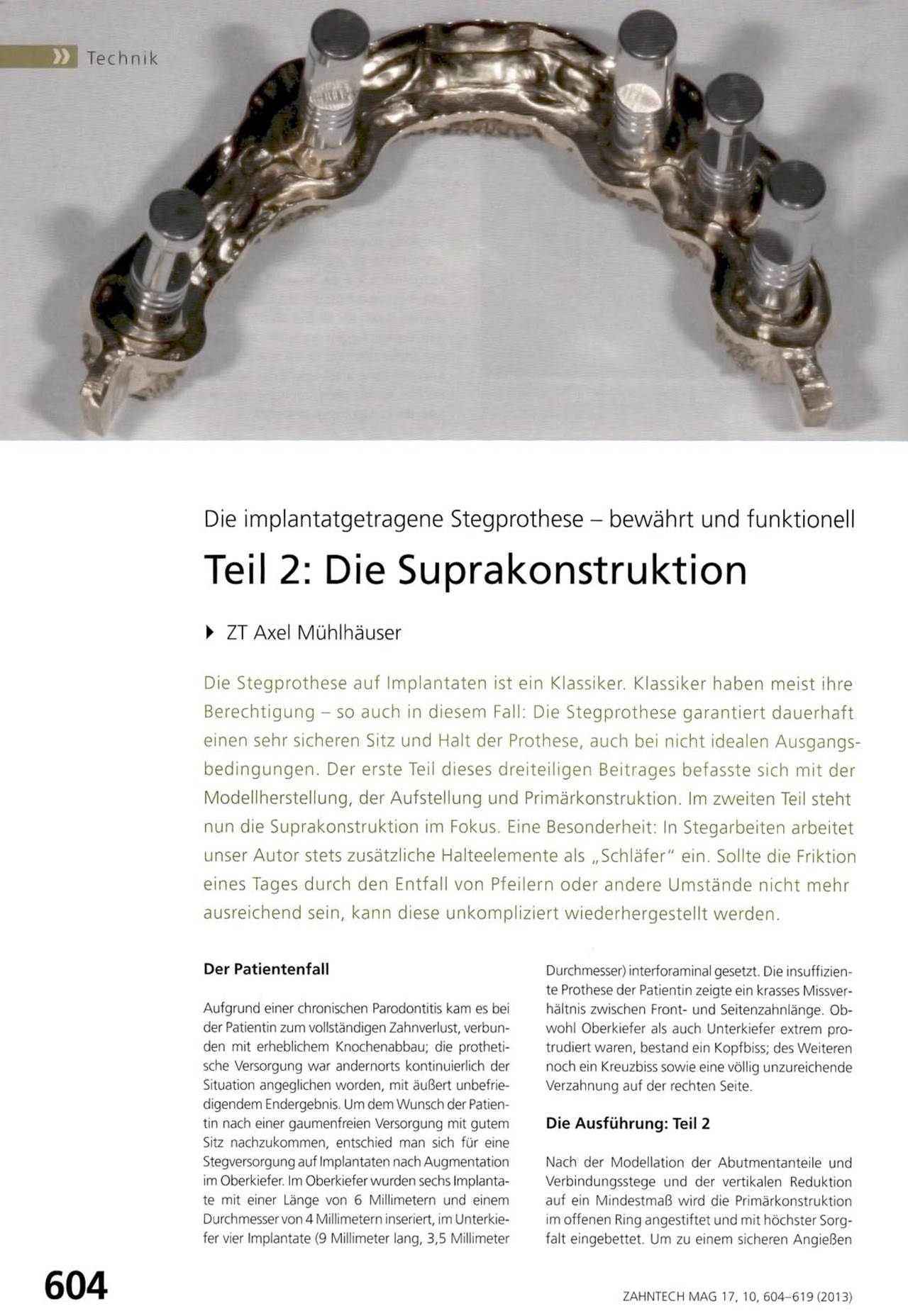 komet-dental-diao-fachbericht-die-suprakonstruktion-teil-2 image 1