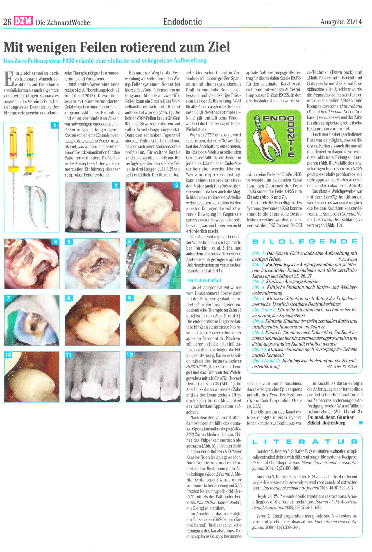 komet-fq-f360-fachbericht-zwei-feilensystem-rotierend-dzw image 1