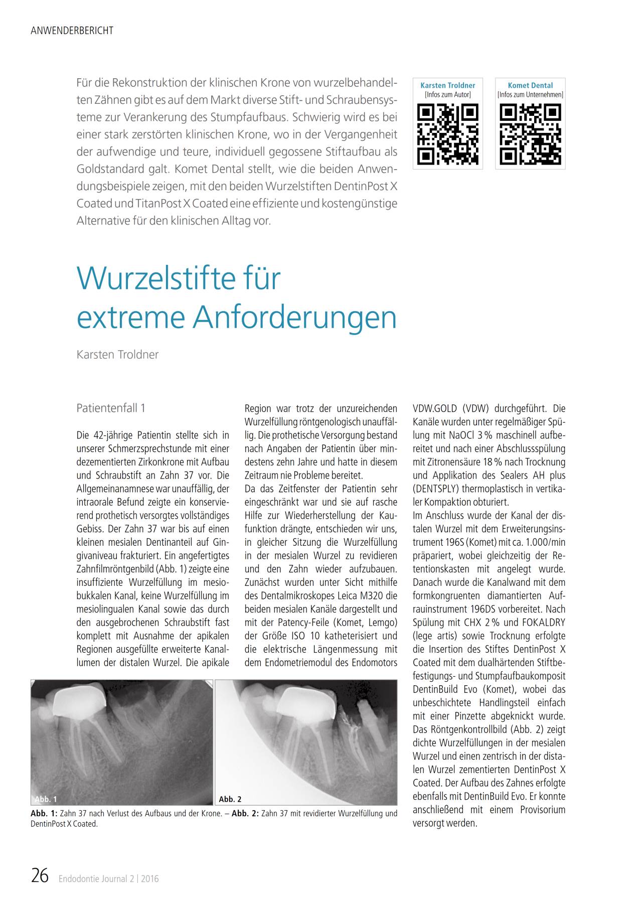komet-dental-cerapost-fachbericht-wurzelstift-aufbau image 1