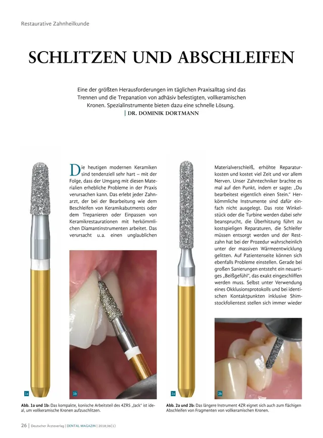 komet-diao-fb-fachbericht-schlitzen-abschleifen-vollkeramik image 1