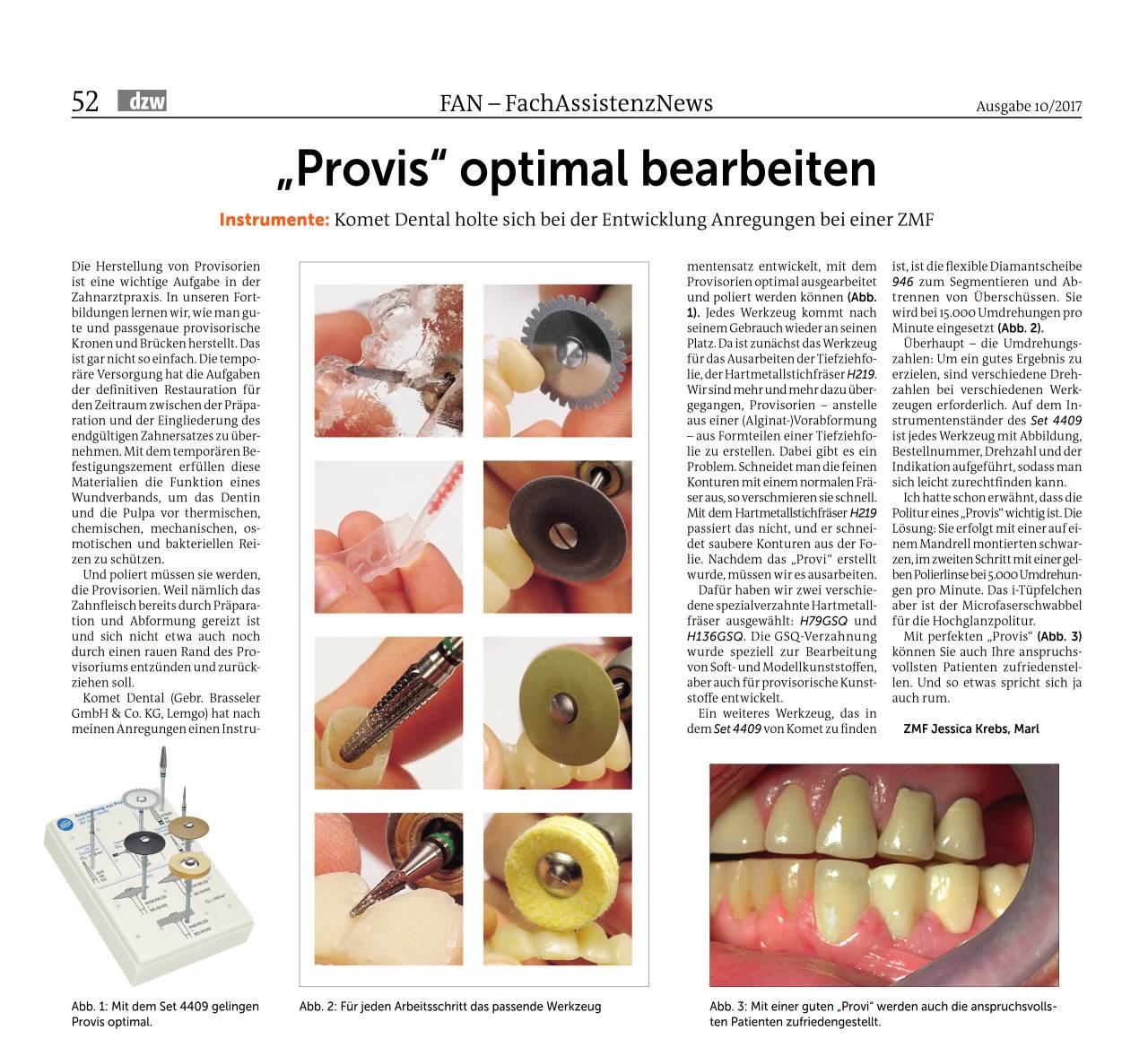 komet-dental-diao-provisorium-bearbeiten-fachbericht image 1