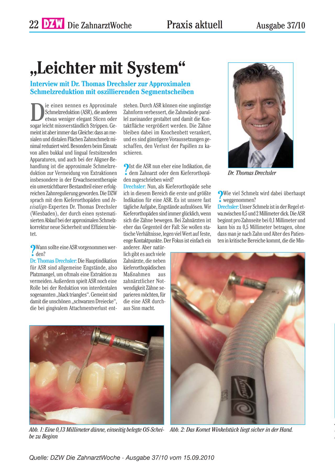 komet-dental-diao-segmentscheiben-fachbericht-oszillierend image 1