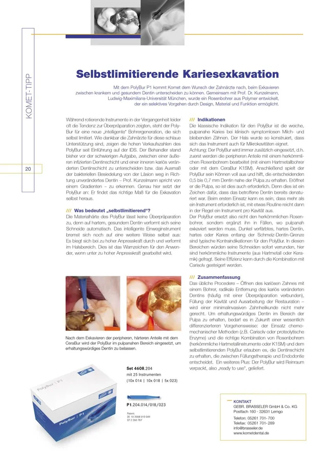 komet-dental-diao-2011-05-fachartikel-polybur-kariesexkavation image 1