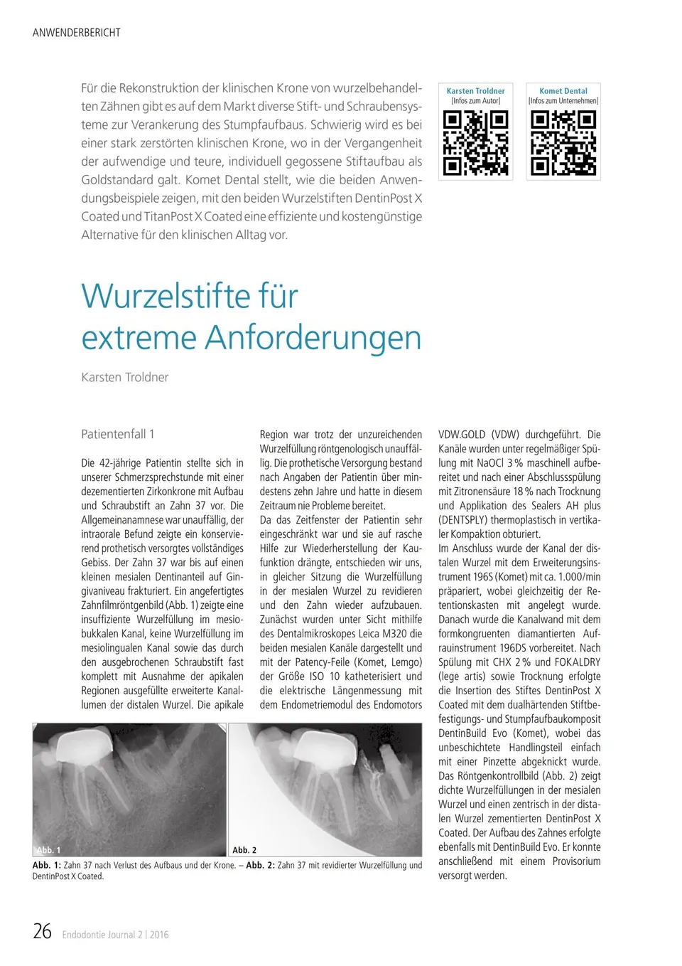 komet-dental-cerapost-fachbericht-wurzelstift-aufbau image 1