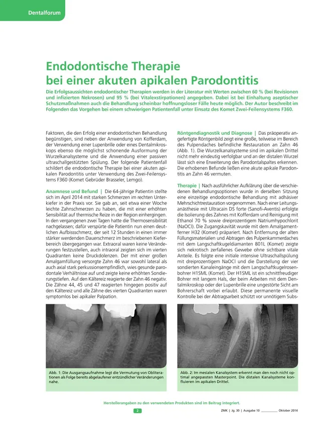 komet-dental-fq-fachbericht-f360-endo-parodontitis-therapie image 1