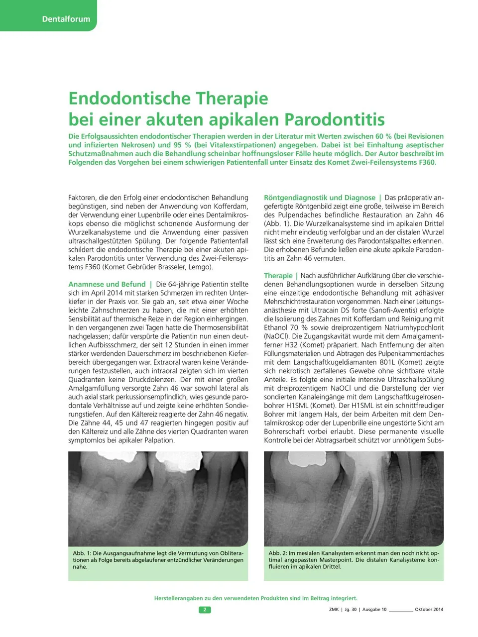 komet-dental-fq-fachbericht-f360-endo-parodontitis-therapie image 1