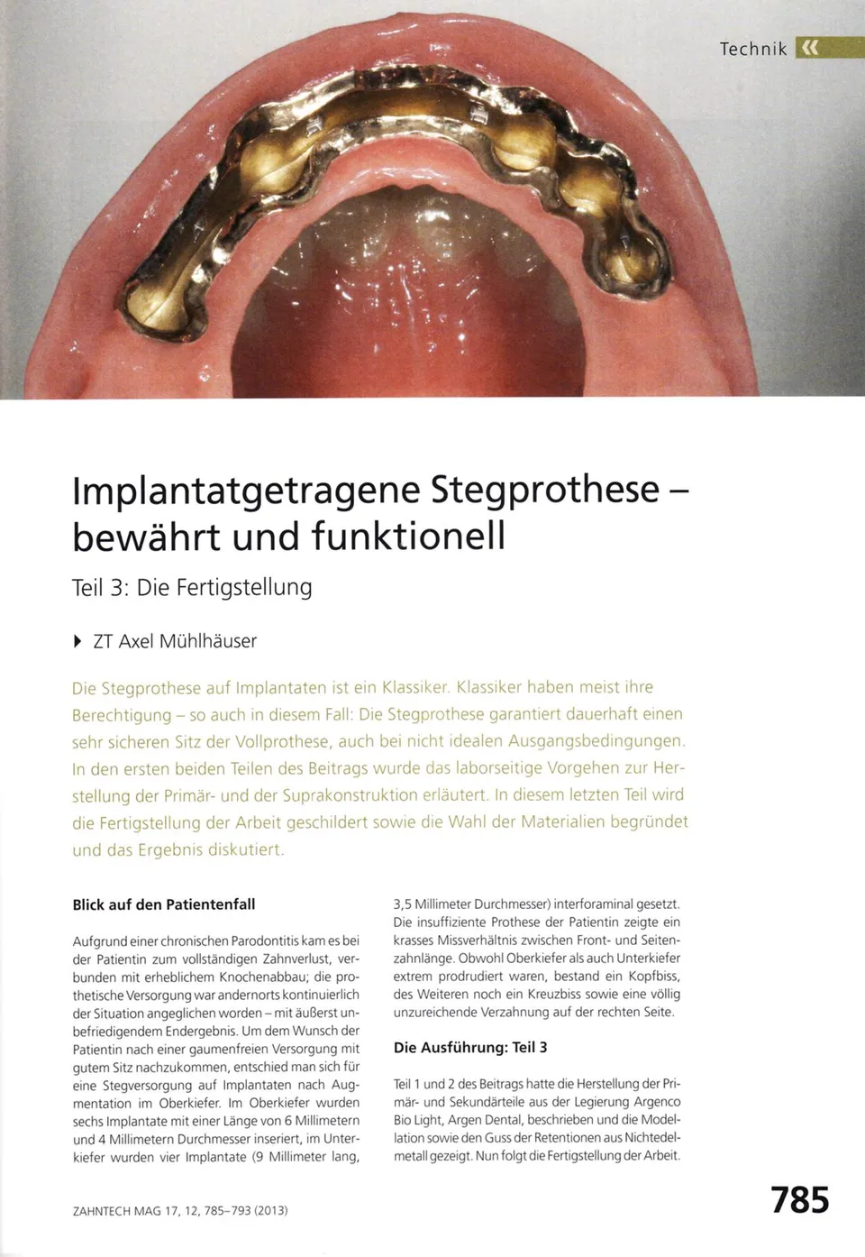 komet-dental-shax-stegprothese-fachbericht-teil-3 image 1
