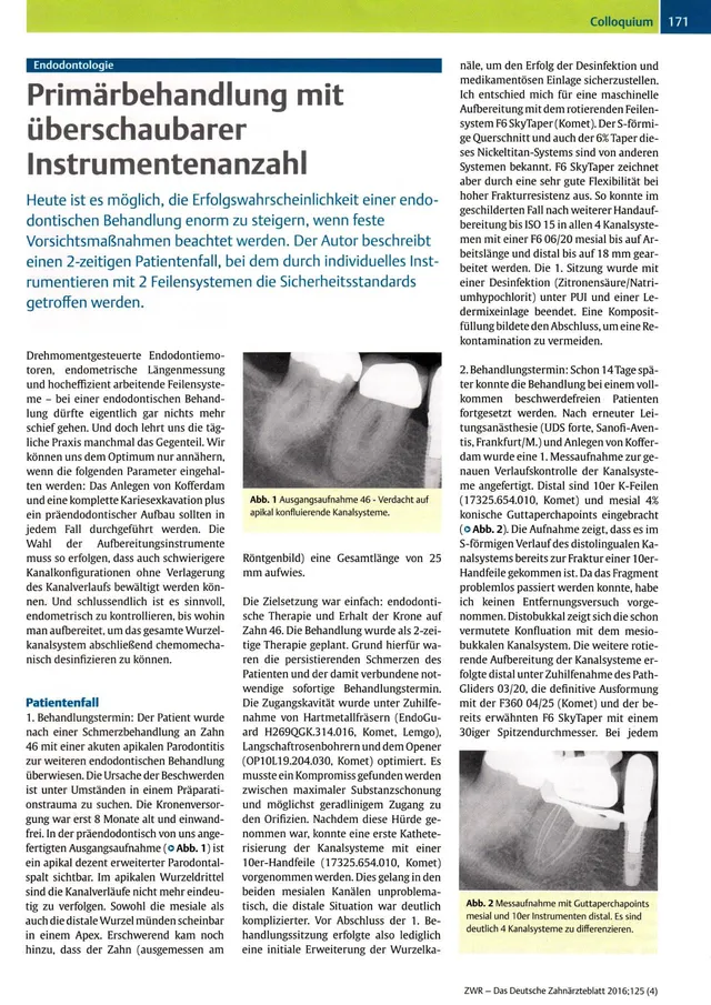 komet-diao-fachbericht-endodontologie-prim-rbehandlung image 1