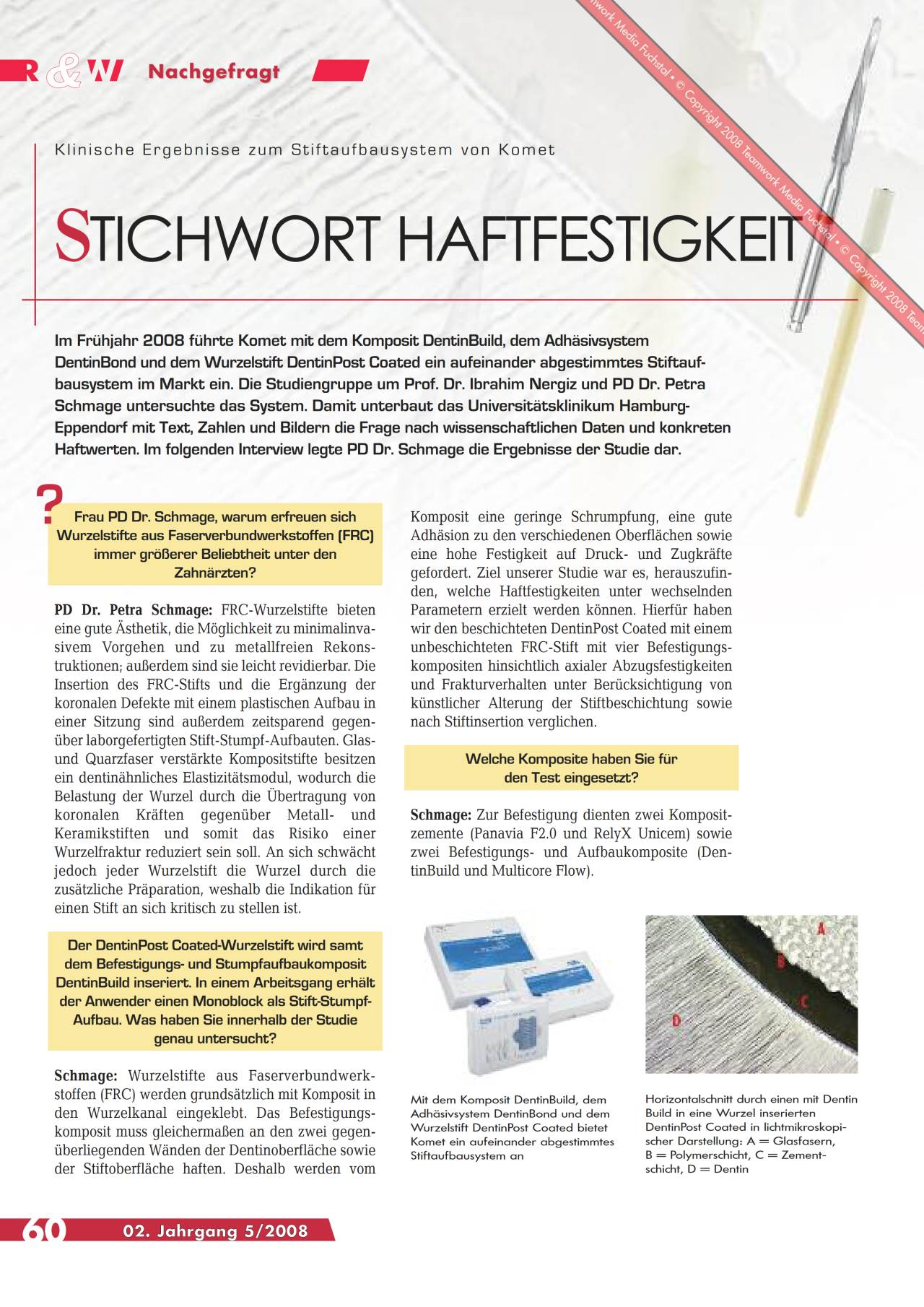komet-ceracut-composite-fachbericht-stiftaufbausystem image 1