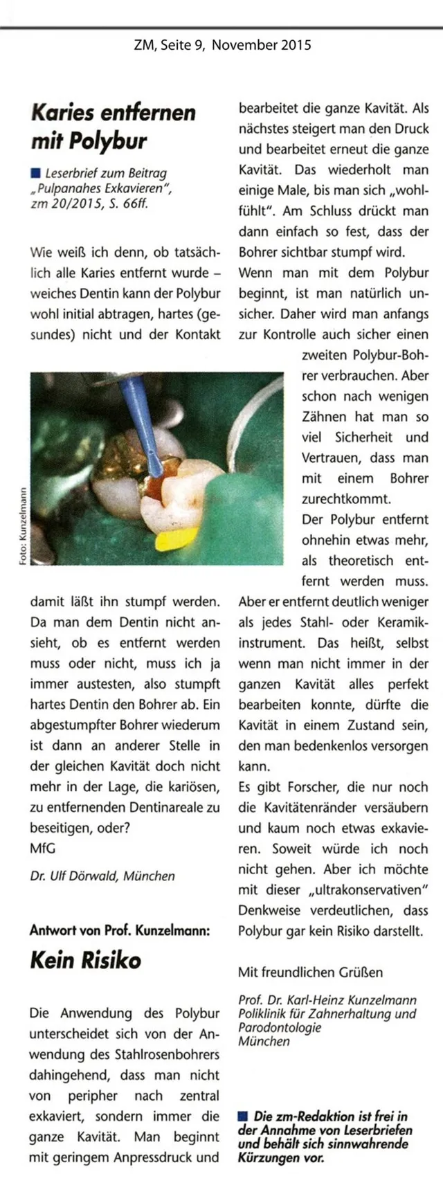 komet-dental-polybur-karies-entfernen-fachbericht-pulpanah image 1