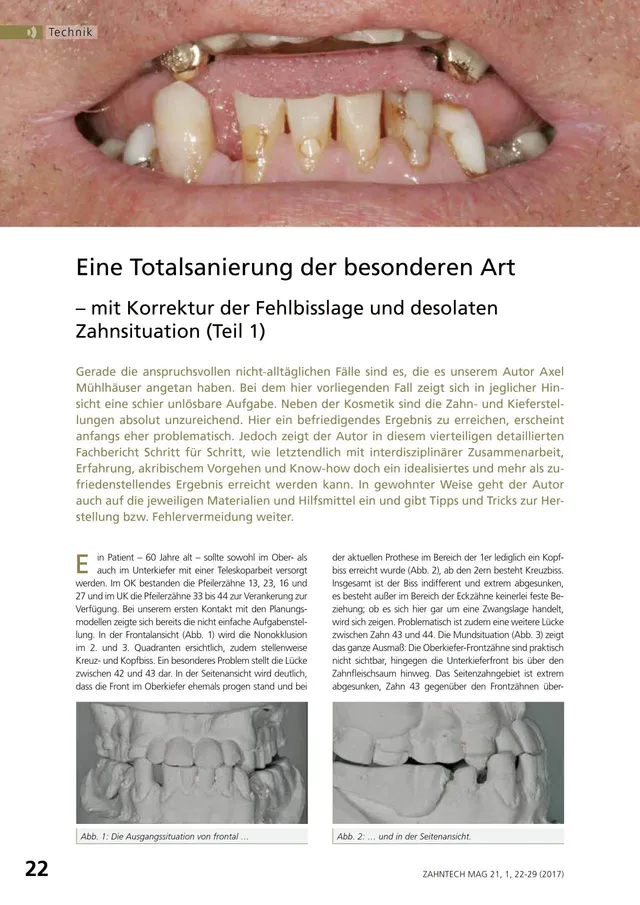 komet-dental-diao-totalsanierung-fachbericht-m-hlhauser-teil-1-4 image 1
