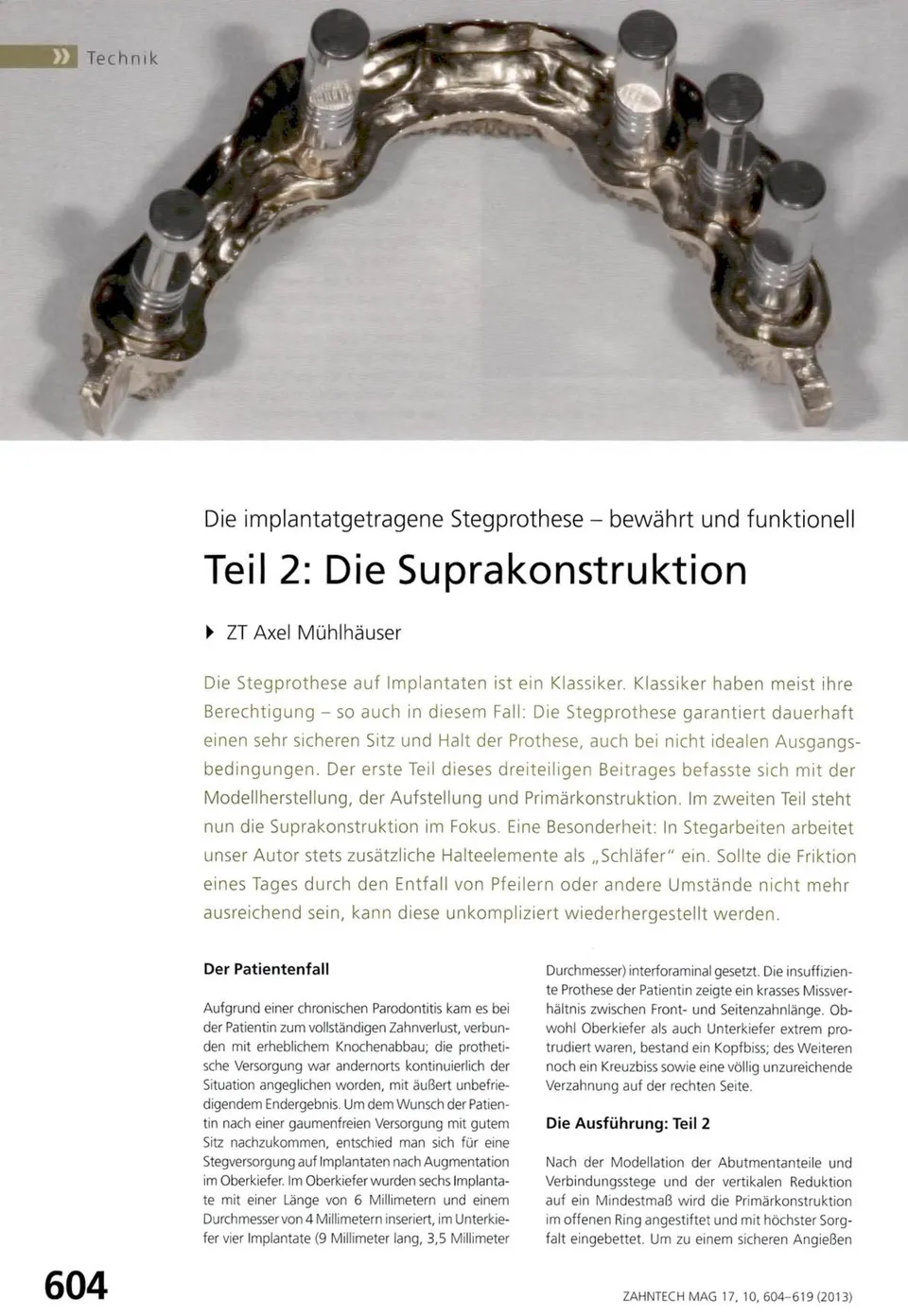 komet-dental-diao-fachbericht-die-suprakonstruktion-teil-2 image 1
