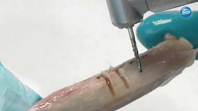 komet-dental-ceradrill-h162st-video-knochenschneider image 1