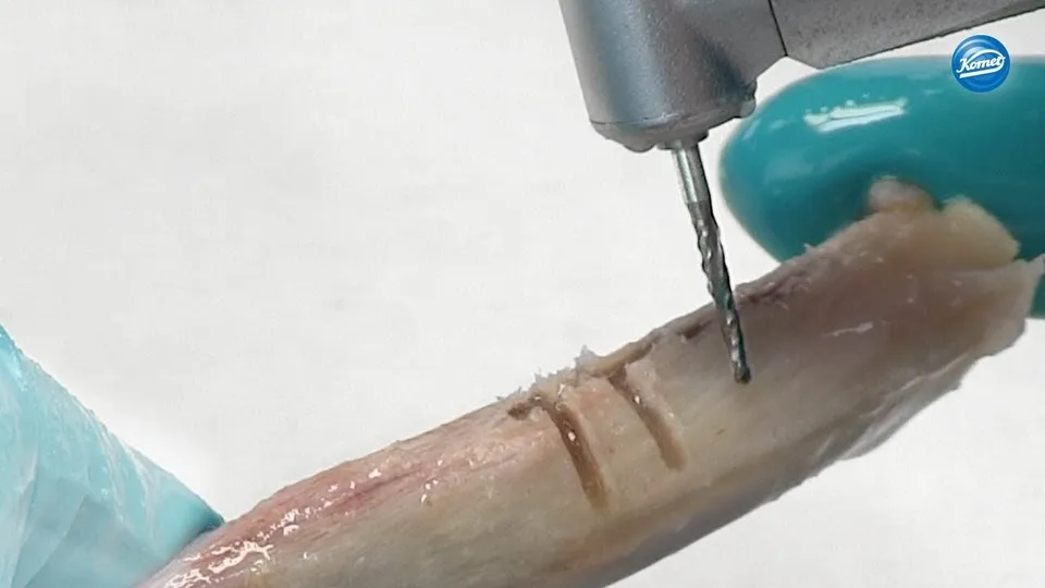 komet-dental-ceradrill-h162st-video-knochenschneider image 1