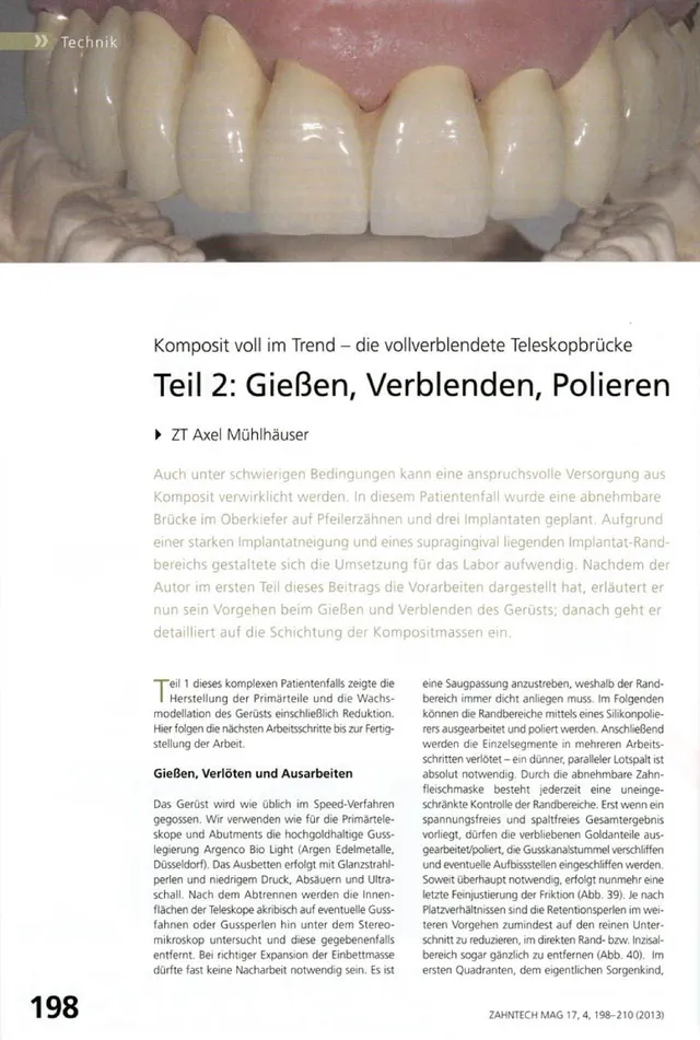 komet-art2-gie-en-verblenden-polieren-teleskopbr-cke-bericht image 1