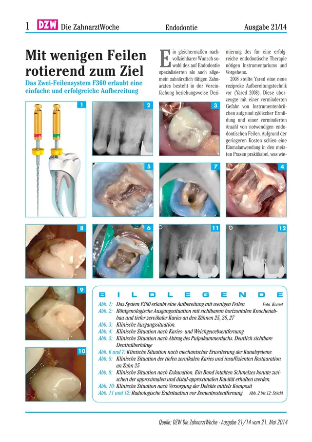 komet-dental-fq-fachbericht-f360-zwei-feilensystem-endo-pdf image 1