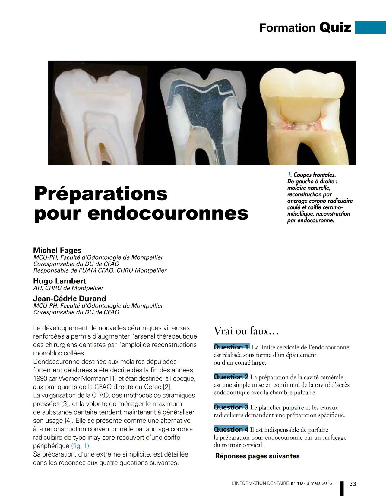 komet-dental-diao-quiz-pr-paration-fachbericht-dr-fages image 1