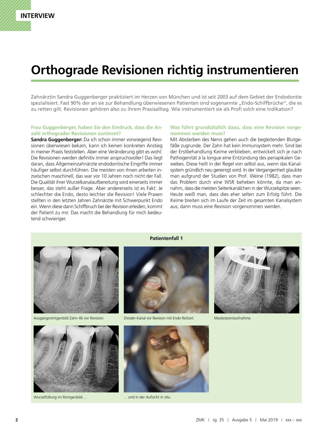 komet-fq-fachbericht-orthograde-revision-endodontie image 1