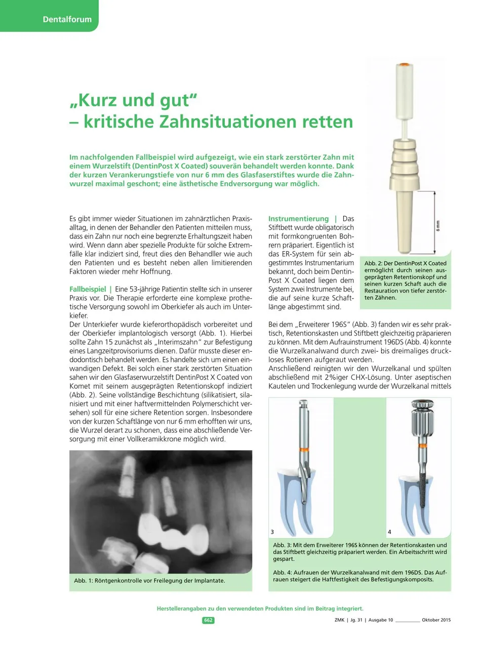 komet-dental-diao-dentinpost-fachbericht-wurzelstift image 1